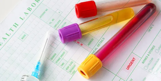 HHS-OIG Releases Opinion on Free Supplemental Cancer Tests